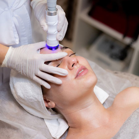 Laser Treatments